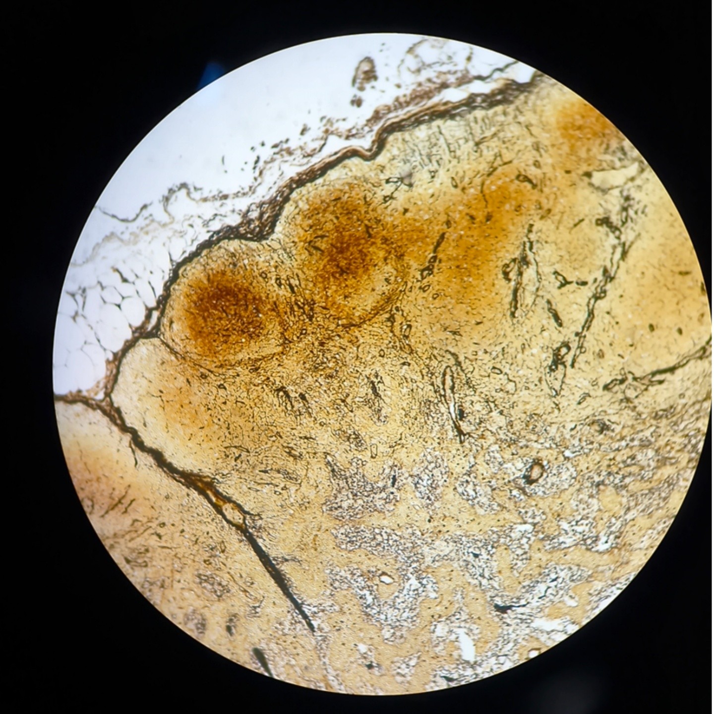 Human Lymph Node Sections Glass Microscope Prepared Slides Silver Staining