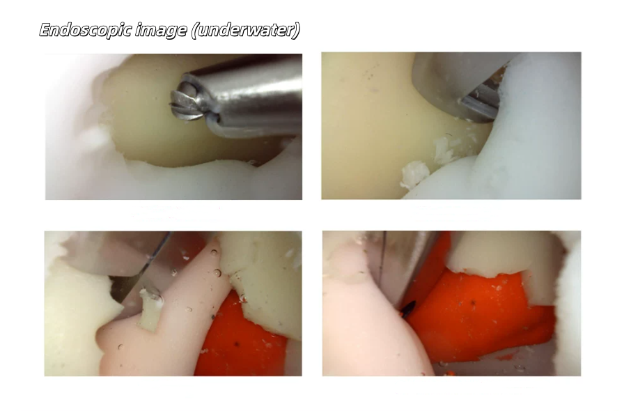 Percutaneous Endoscopic Foraminoscopy Training UBE Surgical Simulator3_副本.png